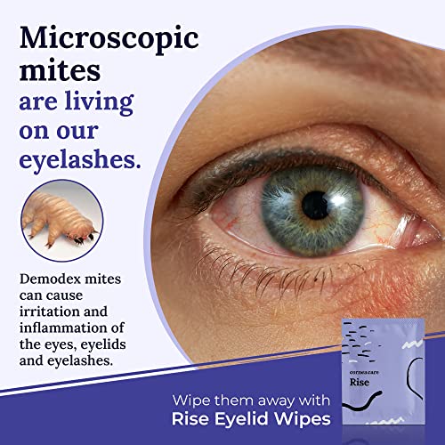 The Eyelid Hygiene Foundation | Self Heating Warm Compress for Eyes | Eye Wipes for Dry Eyes | Eye Compress for Puffy Eyes | Eye Mask for Fast Relief of Dry Eyes | Eyelid Wash Pads | Travel Friendly