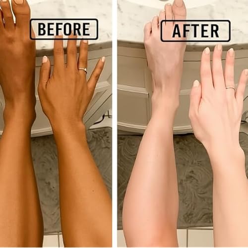 Iguana Glutathione Skin Whitening Soap | Brightening & Even Tone Bath Bar for All Skin Types | 75g x 4 Pack | Gentle, Moisturizing & Radiance-Enhancing Soap