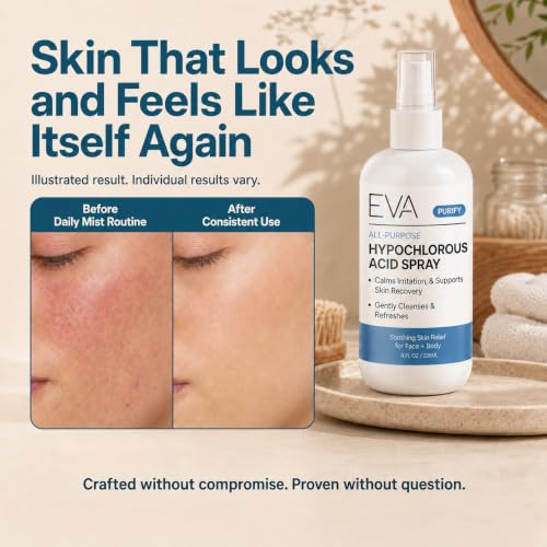 Eva Naturals Hypochlorous Acid Spray 8 Fl Oz Pack of 2 - Face & Body Mist for Sensitive Skin, Redness & Irritation Relief