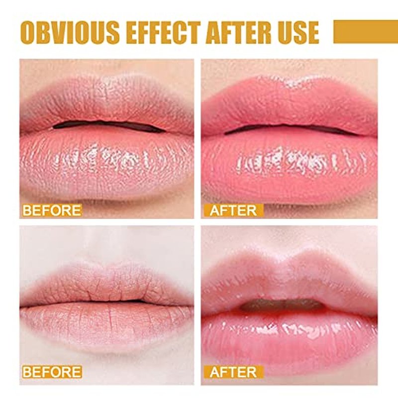 4Pcs Lip Balm Honey Pot, Propolis Moisturizing Honey Lip Mask Lip Balm, Reduces Lip Lines, Prevention Dry and Cracked Lip Scrubs Exfoliator. ¡¦