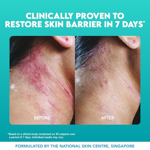 Rapid Itch Relief Cream for Eczema Psoriasis Sensitive Skin 2.53 fl oz