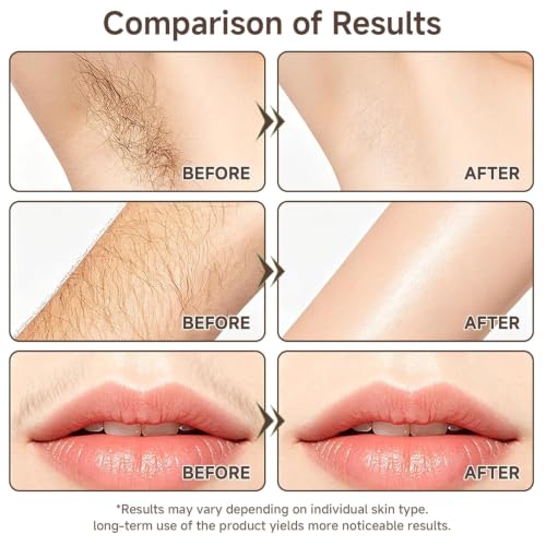 Cyperus Rotundus Oil for Hair Removal & Skin Care - Natural Body Oil