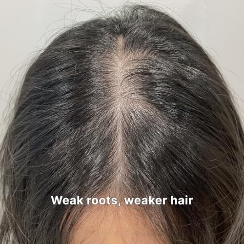 Black Grain Strengthening Shampoo for Thinning Hair 16.9 fl oz - Volumizing & Scalp Care