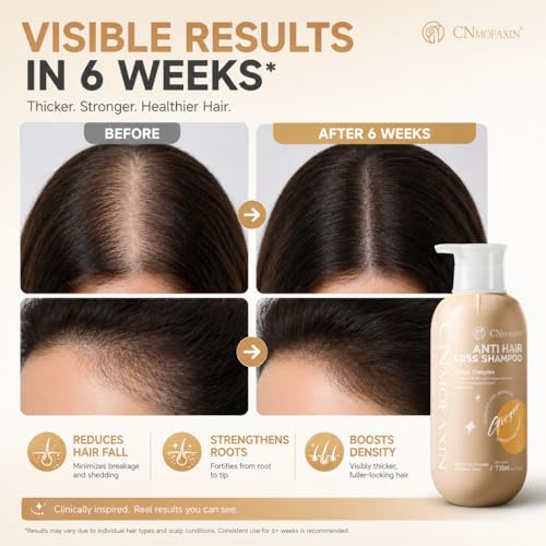 Anti Hair Fall Shampoo 730ml with Multi-Peptide & Root Activator for Thinning Hair