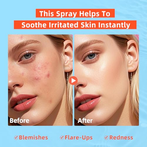 dewyhour Hypochlorous Acid Spray: Facial-Spray Hypochlorous Acid for Face, Soothes Sensitive Skin, Reduces Irritation, Clears Pores, First Aid Relief, 3.38 FL Oz