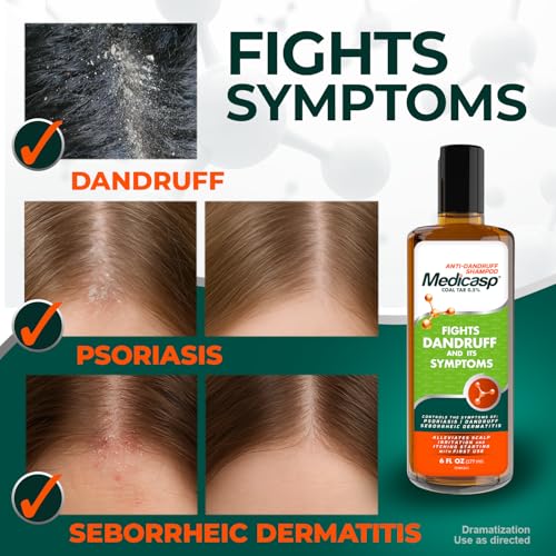 Medicasp Coal Tar Anti-Dandruff Shampoo 6 fl oz Pack of 3 - Relieves Flakes & Itching