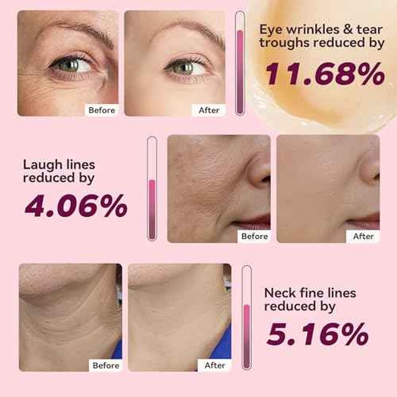 Calcium Multi Balm Stick for Face, Eyes, Lips & Neck ? Korean Collagen Moisturizing Balm with Vitamin D & Shea Butter ? Firming, Hydrating & Skin Barrier Care Stick for All Skin Types