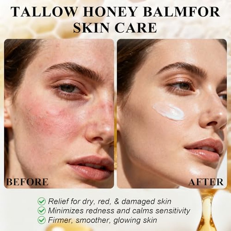 2 Pack Bee Venom Cream,7X Moisturizing Effect than Traditional Tallow Balm,100% Glass Fed Tallow for Skin with Organic Bee Venom,Bee Venom Skin Cream for Dry Skin, Face & Body Moisturizer