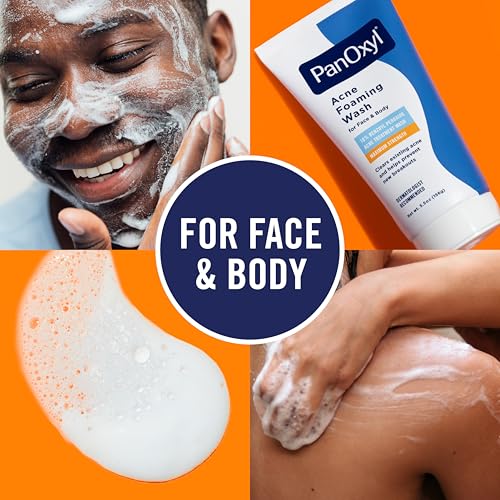 Pimple Patches for Face, 4 Size 300 Counts Acne Patches, Hydrocolloid Patches for Covering Zits and Blemishes, Spot Stickers with Salicylic Acid, Tea Tree Oil & Calendula Oil