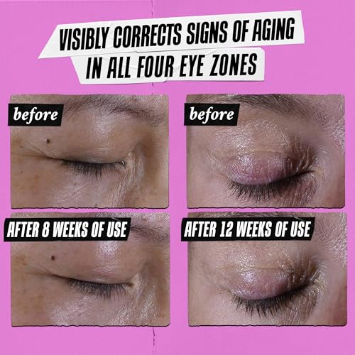 Kiehl's Super Multi-Corrective Eye Cream, Anti-Aging Cream that Lifts Brow Bone Area, Smooths and Firms Eye Lids, Bilberry Seed Extract and Collagen Peptide for Tighter and Smoother Looking Skin
