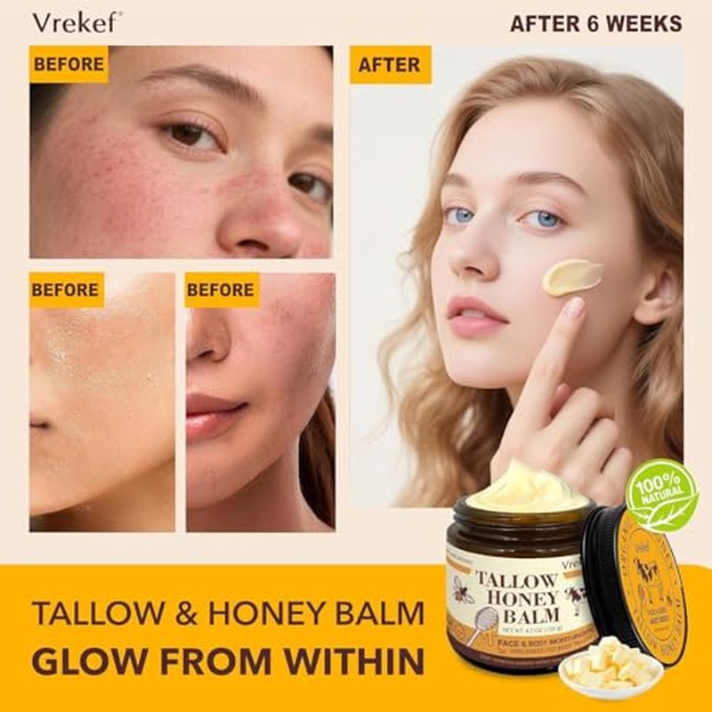 Beef Tallow for Skin (4.2 oz)? Tallow and Honey Balm for Face & Body ? Grass-Fed Tallow with Beeswax, Sea Buckthorn Oil, Shea Butter, Vitamin E ? Natural Moisturizer