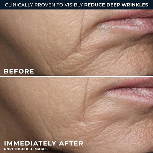 RoC Deep Wrinkle Rich Cream 1.7 Fl Oz Anti-Aging Firming Moisturizer - Fragrance-Free