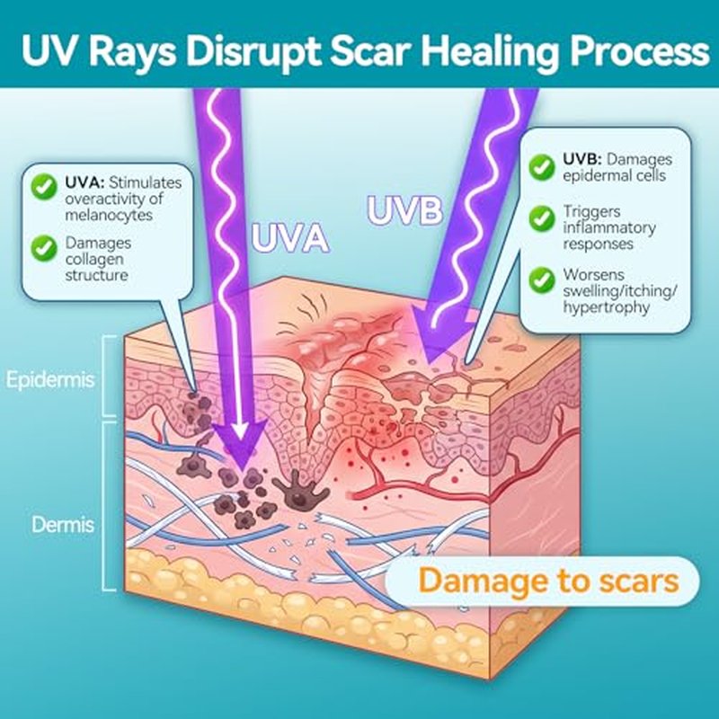 Dimora UPF50+ Silicone Scar Sheets with UV Protection Reusable Sheets to Soften, Flatten Fade Scars, Reduce Redness for Surgical, C-Section, Burn, Keloid, and Hypertrophic Scars (1.6¡±x78.7 Roll)