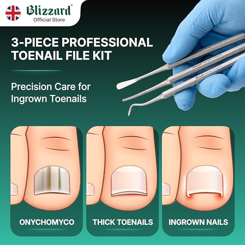 Ingrown Toenail File Set by Blizzard ? 3 Piece Double-Ended Tool Kit with Blacks File, Nail Cleaner and Lifter for Cleaning and Care of Ingrown Toenails - Premium Stainless Steel