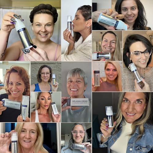 Melasma Treatment for Face - Melasma Cream & Dark Spot Remover - Post-Blemish & Skin Discoloration - Variation: Melasma Cream
