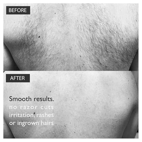 Body & Back Hair Removal Kit with Depilatory Cream, Extendable Applicator & Loofah