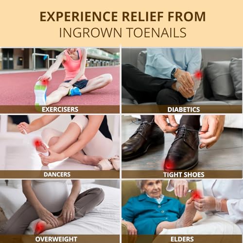 Ingrown Toenail Relief Drops & Removal Kit - 2 Pack, 1 Fl Oz Each - Toe Nail Lifter & Silicone Caps