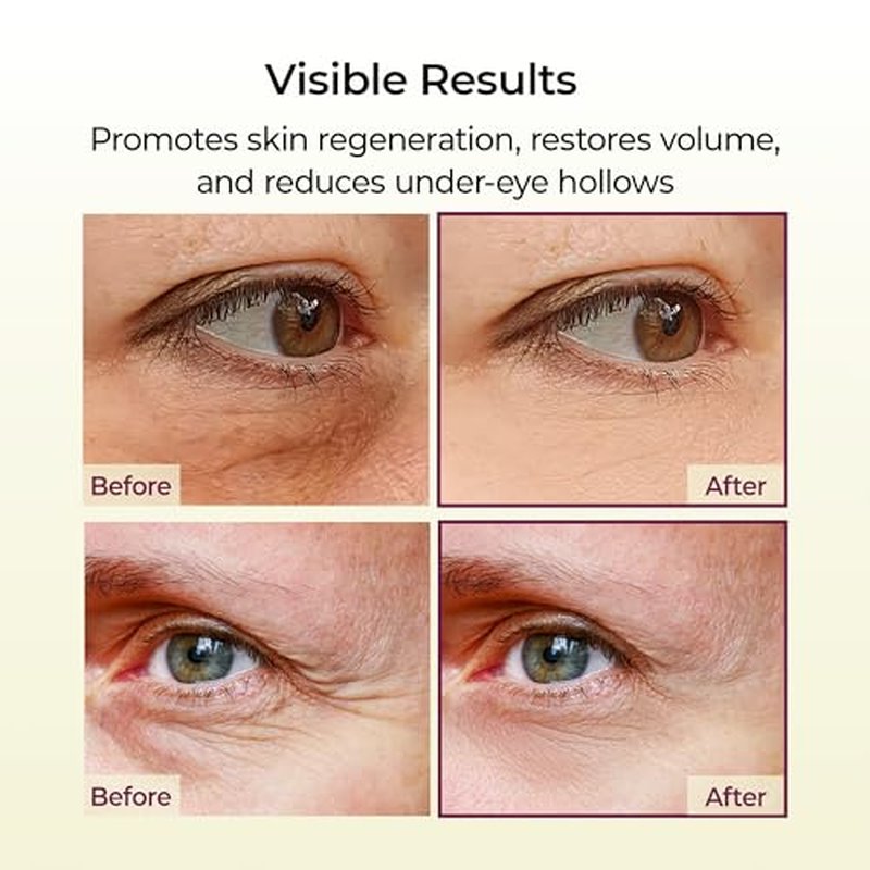 Dr.Melaxin Cemenrete Calcium Multi Balm 9g Korean Skin Care All In One Stick Collagen Face Eye treatment Balm