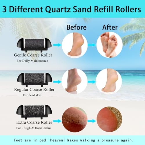 CIVYPRO Black Electric Foot Callus Remover Rechargeable Pedicure Tool Waterproof