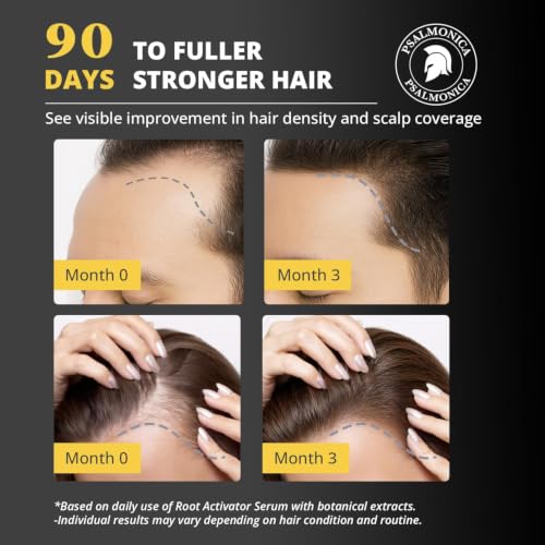 Hair Growth Serum for Men & Women - Root Activator & Thinning Hair Treatment - 1 Fl Oz - Botanical DHT Blocker & Thickening Formula
