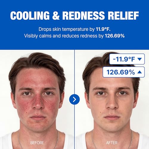Men's Cooling Niacinamide Serum for Acne Marks & Hydration - 50ml