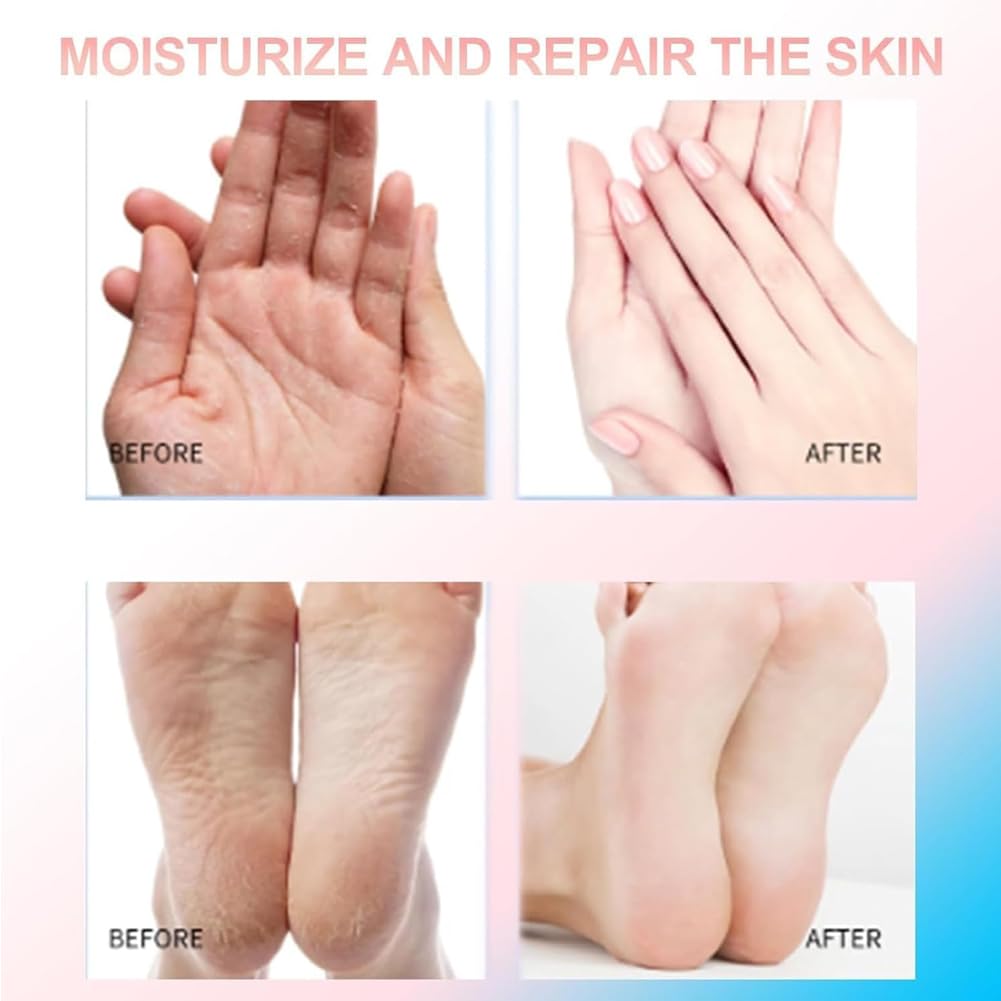 Eourhsa Crack Feet Prevention Stick, Eoursha Crack Heel Cream, Foot Care Cream Roll On, Equrhsa Foot CareCream Cracked Feet, Hydrating And Anti-Cracking FootCream (Pink)