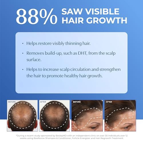 BosRevive Nourishing Rosemary Shampoo for Thinning Hair - Sulfate-Free 10.1 Fl Oz