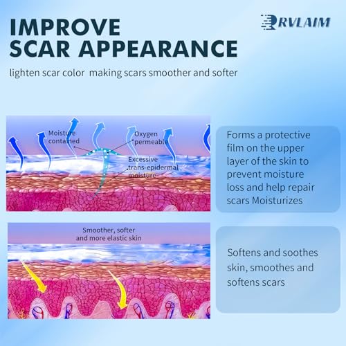 Silicone Scar Cream Scar Gel, Advanced Scar Removal Cream for Surgical Scars, Acne Marks, Stretch Marks, Keloids, C-Section, Burns, Old and New Scars, 1.7 fl oz