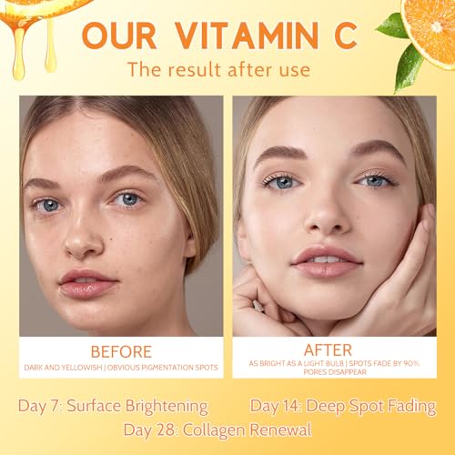 Vitamin C Serum for Face, 20% Vitamin C Brightening Serum with Hyaluronic Acid & Vitamin E, Anti-Aging, Brightening, Improve Dark Spot, Fine Lines & Wrinkles, 1 Fl Oz
