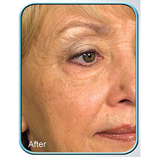 Stem Cell Therapy Cream - Anti-Aging Skin Rejuvenation 1oz Pack of 1