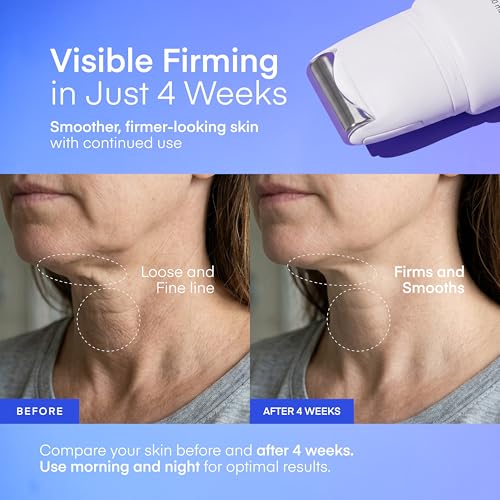 Neck Firming Cream with Gua Sha Massage Roller - Korean Retinol Collagen - 1.7 FL OZ - Variation 1