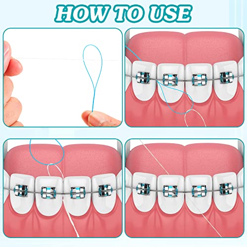 Dental Floss Threaders for Bridges - Blue, Pack of 1000