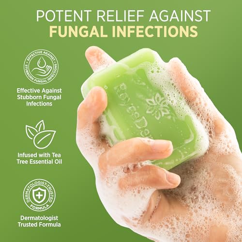 Roycederm Antifungal Bar Soap - Tea tree Oil Soap - Athlete¡¯s Foot Treatment for Jock Itch & Ringworm - Medicated Antifungal Soap with Clotrimazole 1% - Tea Tree Oil Scent, 1 Pack
