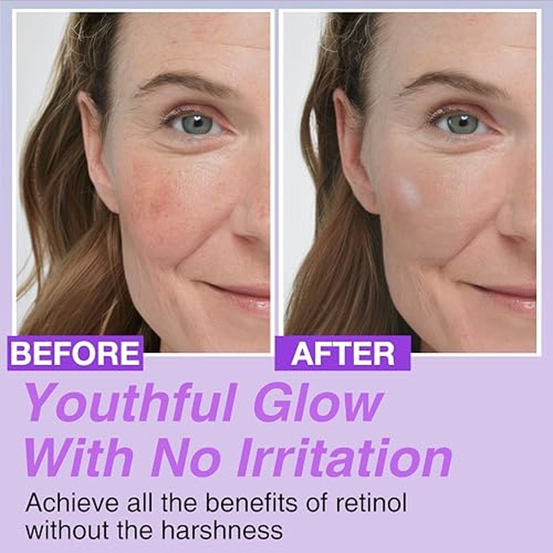 Korean Bakuchiol & Beta-Glucan Serum Bundle ? 30,000 ppm Bakuchiol & 400,000 ppm Beta-Glucan for Wrinkle Reduction, Skin Firming & Intense Hydration ? Anti-Aging & Soothing Korean Skincare for Sensiti