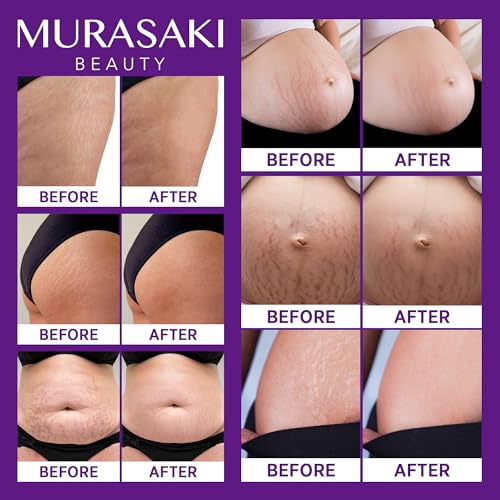 Stretch Mark Cream Prevention for Pregnancy - Maternity Cream 4 oz (120g)