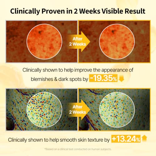 Vitamin C Serum Brightening & Hydrating Skin Care for Dark Spots - 0.4 fl oz