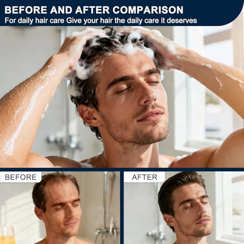 Root Activator Shampoo for Men & Women - Hair Growth & Thinning Solution with Herbal Extracts - 10.1 Fl Oz / 300ml