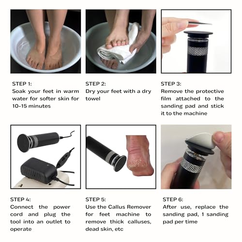 High Power Electric Foot Callus Remover, 2025 Upgrade with 100-inch Extra-Long Cord and 60 Replaceable Sandpaper Discs, Electric Foot File for Cracked Heels and Dead Skin, Rose Pink