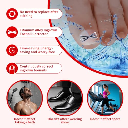 Upgraded Titanium Alloy Ingrown Toenail Corrector with Upgraded 6-Angle Shape,3x Stronger Pull Force,Ingrown Toenail Removal Kit, Ingrown Toenail Treatment for Women and Man (S size - 6 Packs)