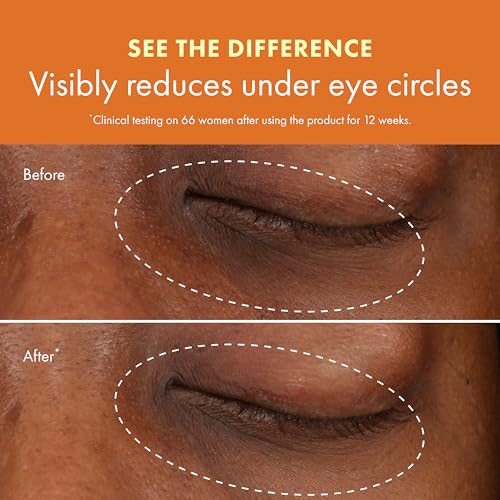 Brightening Eye Cream for Dark Circles & Puffiness - Medium to Deep Skin Tones - Warm Variation