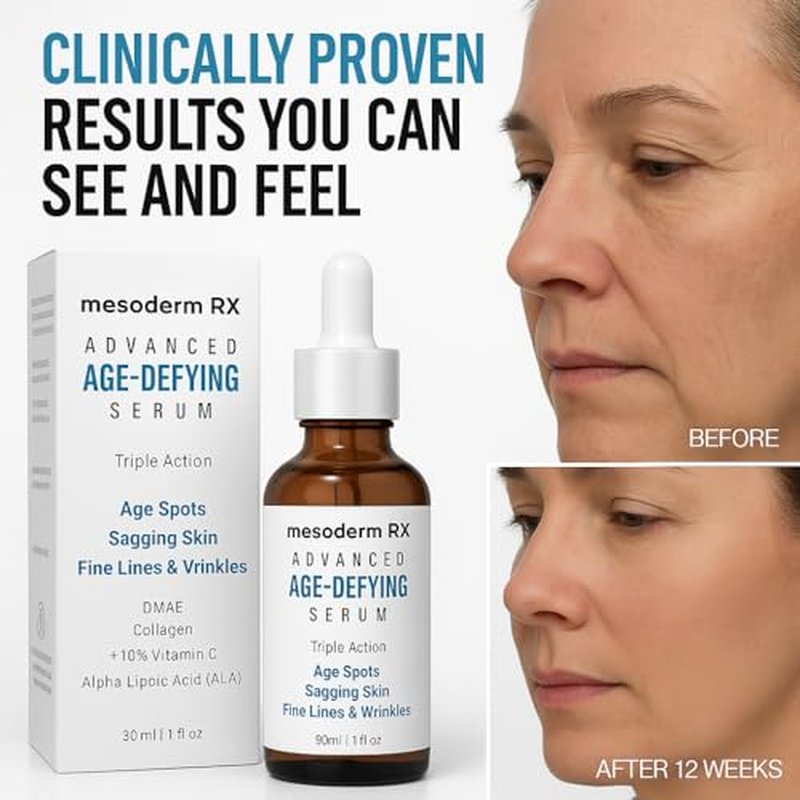 Advanced Age-Defying Serum, Triple Action for Age Spots, Sagging Skin, Fine Lines & Wrinkles, 1 fl oz