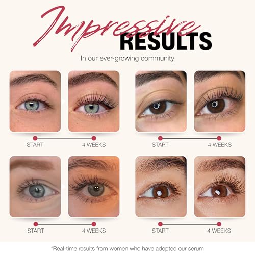 ROSEGOLD Paris ROSELASH Eyelash Growth Serum - Longer, Thicker Lashes