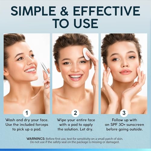 NUVADERMIS 35% Glycolic Acid Peel Pads ? Exfoliating Facial Resurfacing for Blackheads, Dark Spots, and Acne ? Safe for Sensitive Skin ? 60 Double-Sided Pads - 2 Pack
