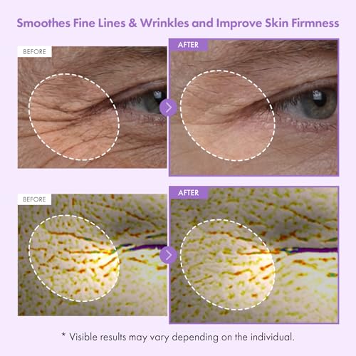 Bakuchiol Capsule Face Cream - Retinol Alternative for Wrinkles & Firming