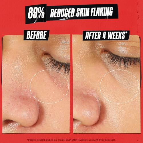 Kiehl's Ultra Facial Meltdown Recovery Barrier Cream 0.95 Fl Oz - Skin Barrier Repair