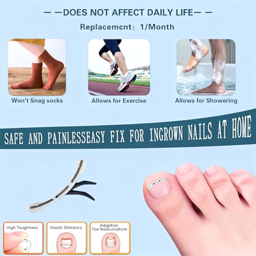 Titanium Alloy Ingrown Toenail Treatment - Professional Home Care for Curved Nails - Waterproof, Nail Tools and Ingrown Toenail Removal Kit,Ingrown Toenail Corrector(0.59/0.67in)