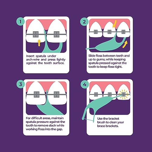 Platypus Orthodontic Flossers for Braces - 30 Count Pack of 5, Dentist Recommended