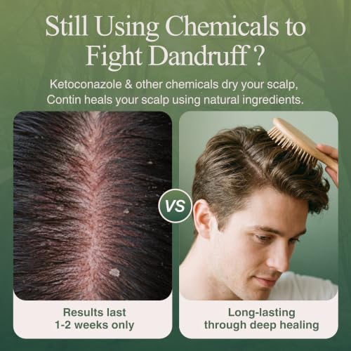 Plant Enzyme Hair Shampoo for Oily Sensitive Scalp 300ml - Clarifying & Volumizing