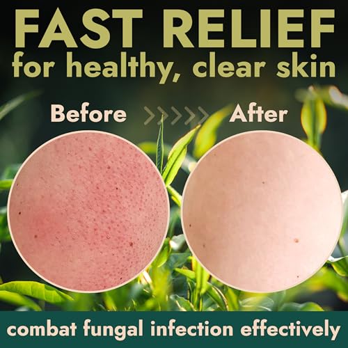 Tea Tree Body Scrub with Brush - Antifungal Exfoliating & Soothing Skin Care