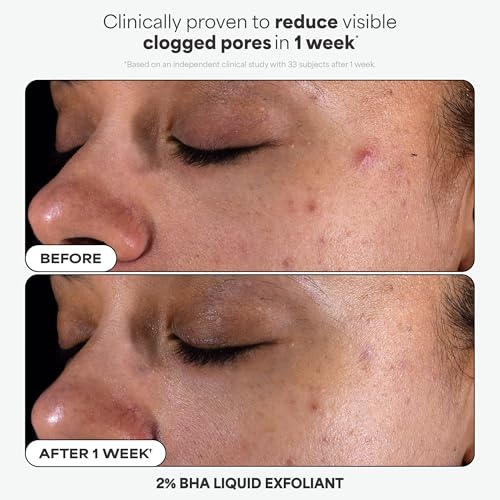 Paula's Choice Complexion Clarity Skincare Set - 3 Piece Kit